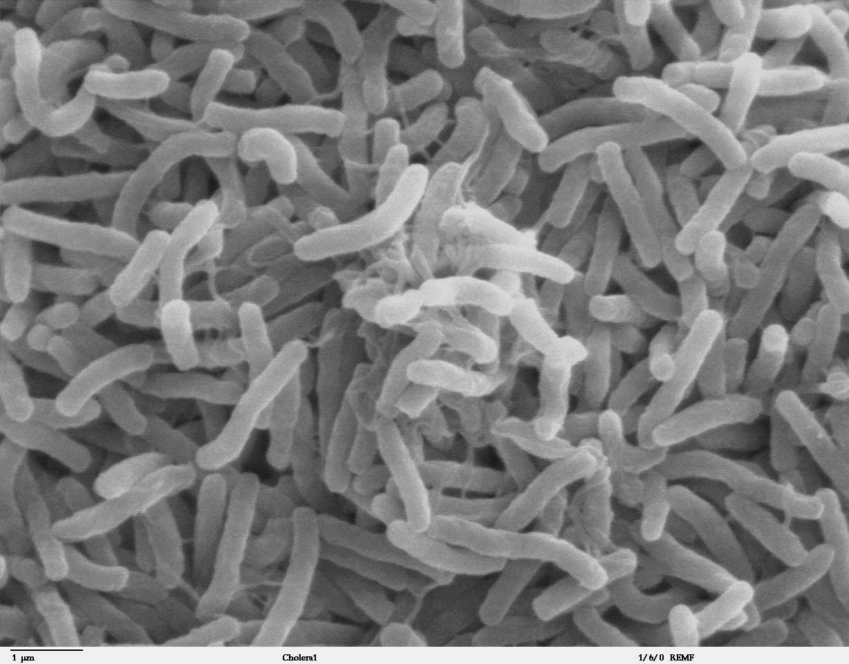 http://medcz.com/wp-content/uploads/2020/11/Cholera_bacteria_SEM.jpg