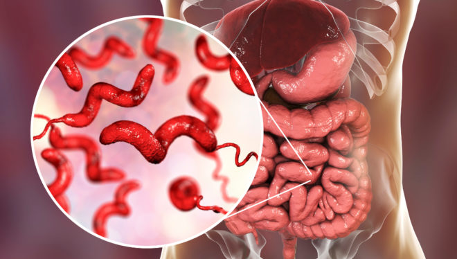 Infekce Campylobacter: příznaky a léčba