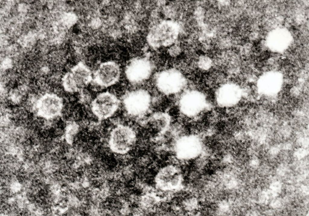 Parvovirus v Blood.jpg