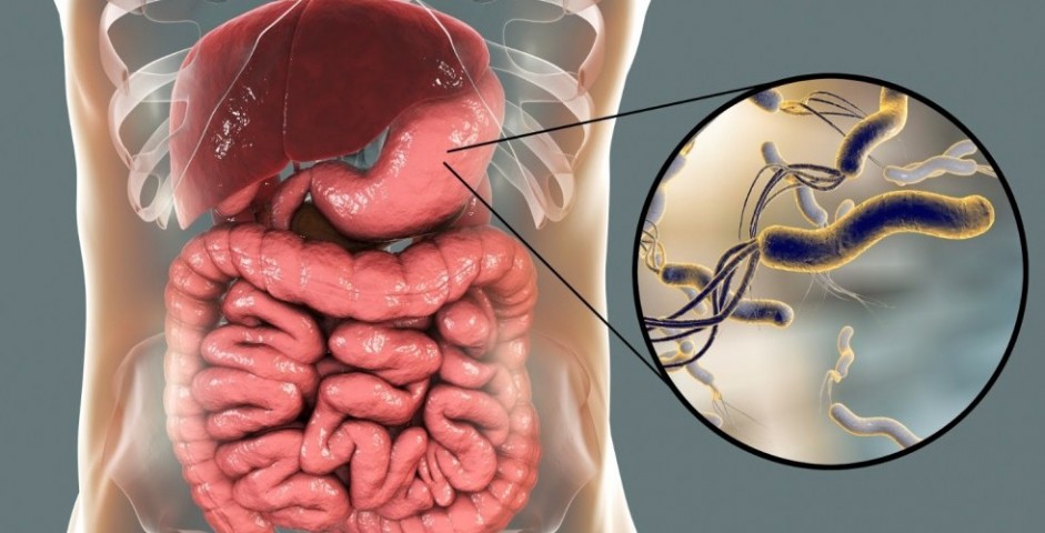 Helicobacter pylori souvisí s nedostatkem železa