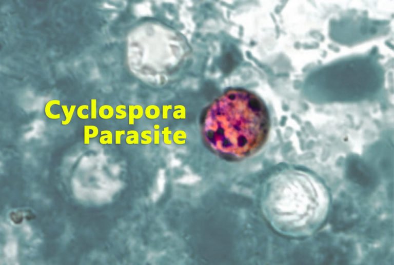 Infekce cyklospora: příznaky, příčiny a léčba