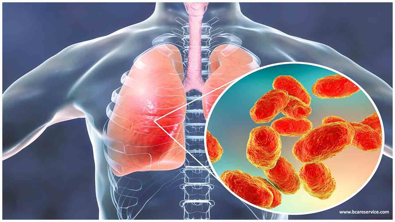 Bakteriální pneumonie: příznaky a léčba