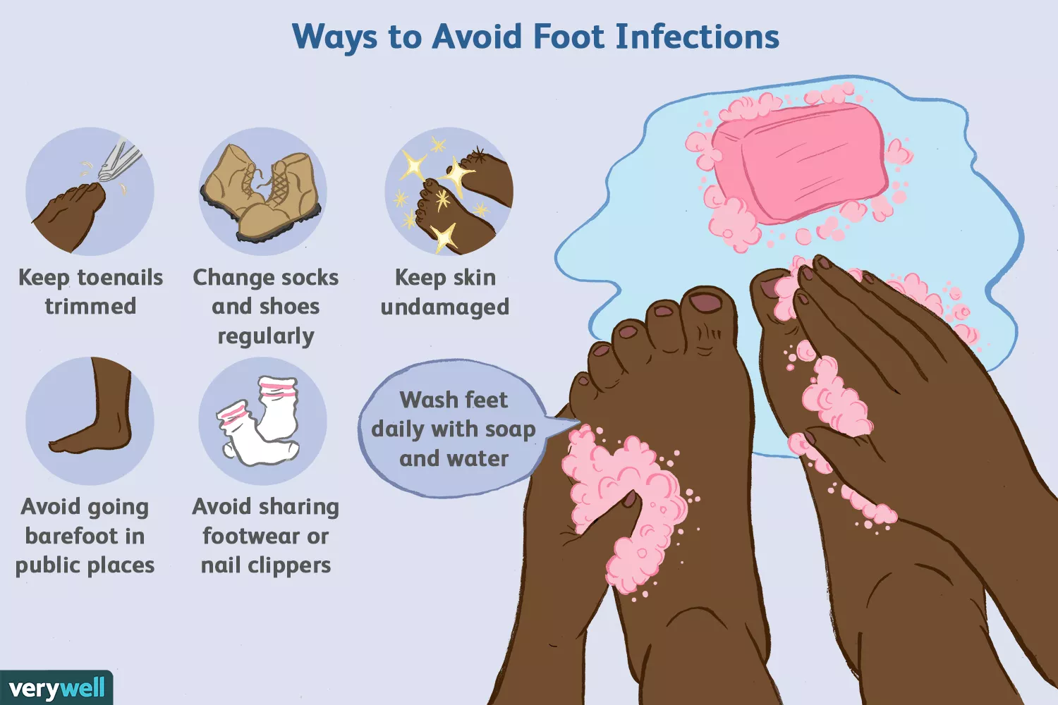 Způsoby, jak se vyhnout infekcím nohou