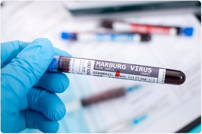 Marburgský virus